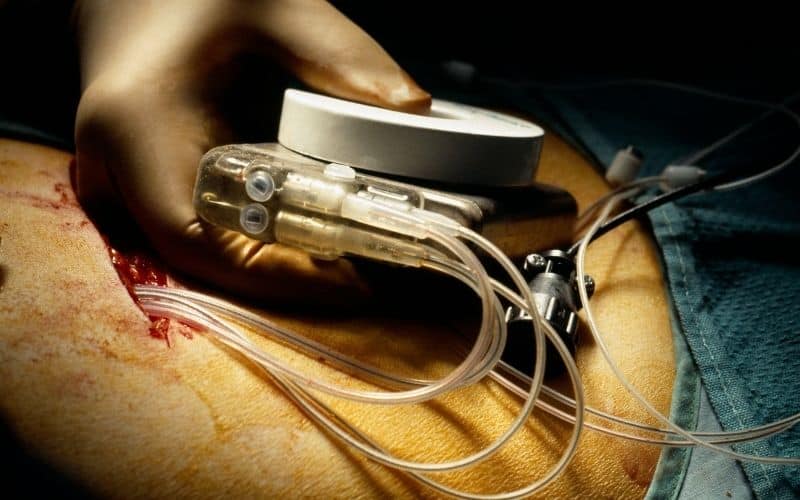 symptoms that a pacemaker isn't working